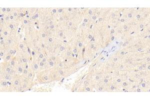 Detection of RAGE in Human Liver Tissue using Polyclonal Antibody to Receptor For Advanced Glycation Endproducts (RAGE)