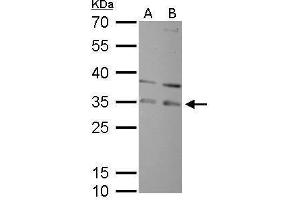 WB Image RPA32 antibody detects RPA2 protein by Western blot analysis. (RPA2 anticorps)