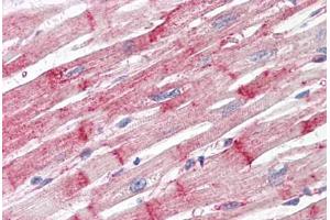Anti-Nestin antibody IHC staining of human heart.