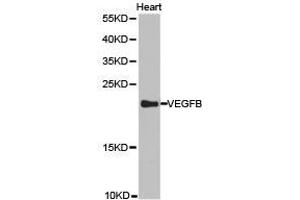 Western Blotting (WB) image for anti-Vascular Endothelial Growth Factor B (VEGFB) antibody (ABIN1875323) (VEGFB anticorps)