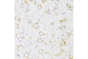 Immunohistochemistry of paraffin-embedded rat brain using BRSK1 antibody  at dilution of 1:100 (40x lens).