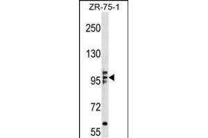 KIF20A Antibody (N-term) (ABIN1539162 and ABIN2848683) western blot analysis in ZR-75-1 cell line lysates (35 μg/lane).