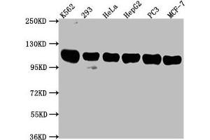 Western Blot Positive WB detected in: K562 whole cell lysate, 293 whole cell lysate, Hela whole cell lysate, HepG2 whole cell lysate, PC3 whole cell lysate, MCF-7 whole cell lysate All lanes: ITCH antibody at 1:2000 Secondary Goat polyclonal to rabbit IgG at 1/50000 dilution Predicted band size: 103, 99, 87 kDa Observed band size: 103 kDa (ITCH anticorps  (AA 29-303))