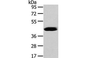 Gel: 8 % SDS-PAGE, Lysate: 40 μg, Lane: Hela cell, Primary antibody: ABIN7128077(VASH2 Antibody) at dilution 1/450 dilution, Secondary antibody: Goat anti rabbit IgG at 1/8000 dilution, Exposure time: 40 seconds (Vasohibin 2 anticorps)