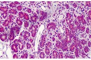 Human Breast: Formalin-Fixed, Paraffin-Embedded (FFPE)