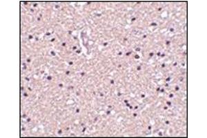 Immunohistochemistry of op18 in human brain tissue with this product at 2.