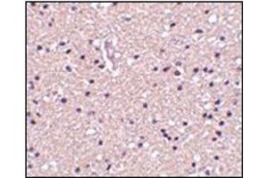 Immunohistochemistry of op18 in human brain tissue with this product at 2. (Stathmin 1 anticorps  (N-Term))