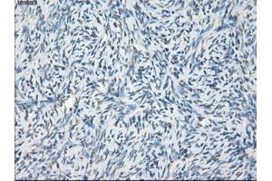 Immunohistochemical staining of paraffin-embedded colon tissue using anti-LTA4H mouse monoclonal antibody. (LTA4H anticorps)