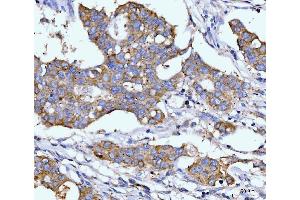 IHC analysis of DHODH using anti-DHODH antibody (ABIN7603139). (DHODH anticorps  (N-Term))