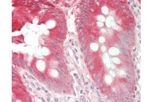 Human Colon: Formalin-Fixed, Paraffin-Embedded (FFPE).