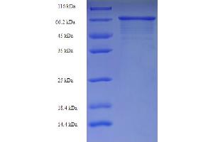 SDS-PAGE (SDS) image for Immunoglobulin Heavy Constant gamma 1 (G1m Marker) (IGHG1) (AA 1-479), (full length) protein (His-SUMO Tag) (ABIN5709729)