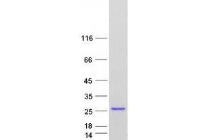 Validation with Western Blot