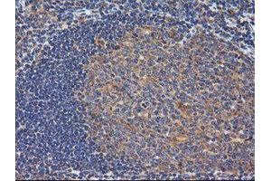 Image no. 4 for anti-Ras Homolog Gene Family, Member J (RHOJ) antibody (ABIN1501341)