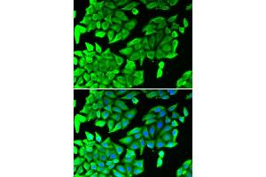 Immunofluorescence analysis of U2OS cells using MAPK8 antibody (ABIN5975840). (JNK anticorps)