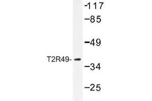 Image no. 1 for anti-Taste Receptor, Type 2, Member 49 (TAS2R20) antibody (ABIN317774) (TAS2R20 anticorps)
