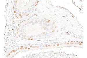 Immunohistochemistry (IHC) image for anti-Androgen Receptor (AR) (AA 1-50) antibody (ABIN7795785) (Recombinant Androgen Receptor anticorps  (AA 1-50))
