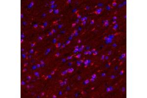 Immunofluorescent analysis of paraformaldehyde-fixed mouse brain using VMAT2 (ABIN7075655) at dilution of 1: 1600