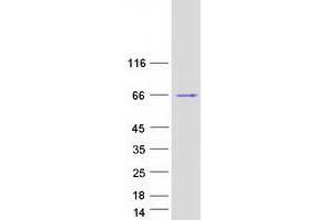 Validation with Western Blot