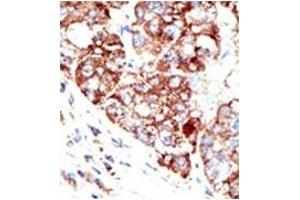 Image no. 2 for anti-Protein Inhibitor of Activated STAT, 1 (PIAS1) (C-Term) antibody (ABIN356763) (PIAS1 anticorps  (C-Term))