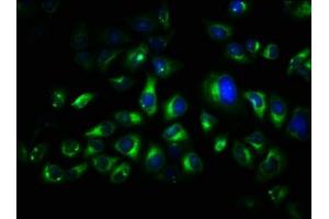 Immunofluorescence staining of Hela cells with ABIN7173546 at 1:66, counter-stained with DAPI. (TRO anticorps  (AA 1-164))