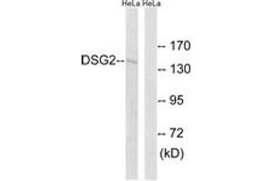 Western blot analysis of extracts from HeLa cells, using DSG2 Antibody. (Desmoglein 2 anticorps  (AA 401-450))