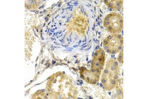 Immunohistochemistry (IHC) image for anti-BCL2-Associated Agonist of Cell Death (BAD) (C-Term) antibody (ABIN3022203) (BAD anticorps  (C-Term))