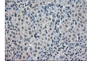 Immunohistochemical staining of paraffin-embedded pancreas tissue using anti-CRYABmouse monoclonal antibody. (CRYAB anticorps)