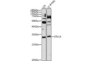 Western blot analysis of extracts of various cell lines, using STX1A antibody (ABIN7270684) at 1:1000 dilution.