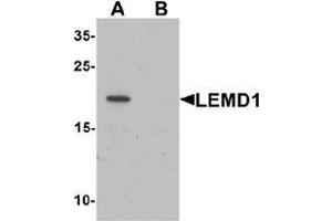 Western blot analysis of LEMD1 in A20 cell lysate with LEMD1 Antibody  at 1 ug/mL in (A) the absence and (B) the presence of blocking peptide. (LEMD1 anticorps  (Middle Region))