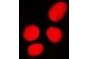 Immunofluorescent analysis of PHC3 staining in U2OS cells. (PHC3 anticorps)