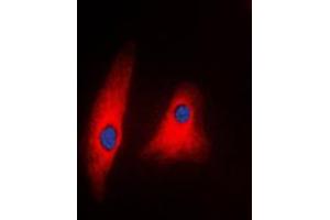 Immunofluorescent analysis of PLC gamma 1 staining in Raw264. (Phospholipase C gamma 1 anticorps  (C-Term))