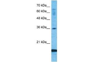 Host:  Rabbit  Target Name:  CCL18  Sample Type:  Fetal Lung lysates  Antibody Dilution:  1. (CCL18 anticorps  (Middle Region))