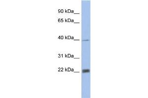 WB Suggested Anti-PSMA4 Antibody Titration: 0. (PSMA4 anticorps  (N-Term))