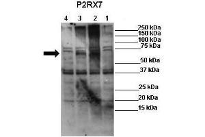 WB Suggested Anti-P2RX7 Antibody  Positive Control: Lane 1: 50ug mock transfected HEK-293Lane 2: 50ug hP2X7 transfected HEK-293Lane 3: 50ug mP2X7 transfected HEK-293Lane 4: 50ug rP2X7 transfected HEK-293 Primary Antibody Dilution :  1:625 Secondary Antibody : Anti-rabbit-HRP Secondry Antibody Dilution :  1:1000 Submitted by: Ronald Sluyter, School of Biological Sciences, University of Wollongong