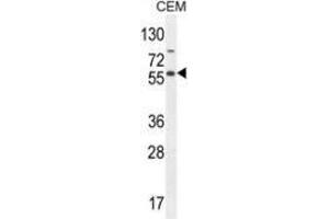 Western blot analysis in CEM cell line lysates (35ug/lane) using NFKBIL1  Antibody . (NFKBIL1 anticorps  (Middle Region))