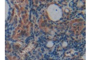 Used in DAB staining on fromalin fixed paraffin- embedded rectum tissue (PLXNB1 anticorps  (AA 200-727))