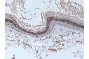 Detection of INV in Rat Skin Tissue using Polyclonal Antibody to Involucrin (INV)