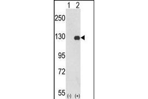 Western blot analysis of PTK2 (arrow) using rabbit polyclonal PTK2 Antibody (C-term) (ABIN652554 and ABIN2842372). (FAK anticorps  (C-Term))