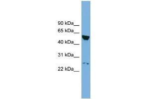 WB Suggested Anti-DEPDC7 Antibody Titration:  0. (DEPDC7 anticorps  (N-Term))