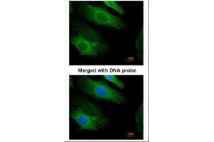 ICC/IF Image Immunofluorescence analysis of paraformaldehyde-fixed HeLa, using H-Ras , antibody at 1:200 dilution. (HRAS anticorps  (C-Term))