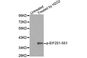 Western blot analysis of extracts from Jurkat cells, using Phospho-EIF2S1-S51 antibody (ABIN2987989). (EIF2S1 anticorps  (pSer51))