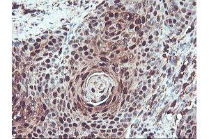 Image no. 3 for anti-serpin Peptidase Inhibitor, Clade B (Ovalbumin), Member 1 (SERPINB1) (AA 77-306) antibody (ABIN1491671)