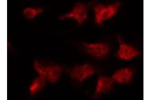 ABIN6274573 staining Hela by IF/ICC.