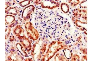 Immunohistochemistry of paraffin-embedded human kidney tissue using ABIN7166667 at dilution of 1:100 (TDRD12 anticorps  (AA 991-1164))
