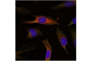 Image no. 2 for anti-Mitogen-Activated Protein Kinase-Activated Protein Kinase 2 (MAPKAPK2) (Thr334) antibody (ABIN197584)