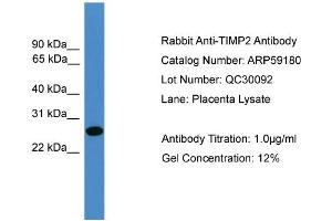 WB Suggested Anti-TIMP2  Antibody Titration: 0. (TIMP2 anticorps  (N-Term))