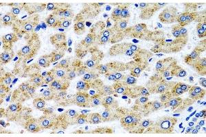 Immunohistochemistry of paraffin-embedded Human liver using SERPINA7 Polyclonal Antibody at dilution of 1:100 (40x lens). (SERPINA7 anticorps)