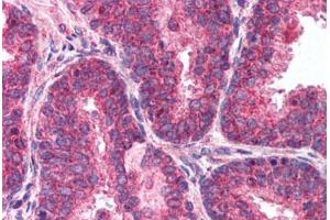 Human Prostate (formalin-fixed, paraffin-embedded) stained with mTOR antibody ABIN214561 at 2.