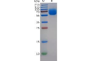 Human T Protein, His Tag on SDS-PAGE under reducing condition.