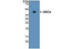 Detection of Recombinant ISR, Human using Polyclonal Antibody to Insulin Receptor (INSR)